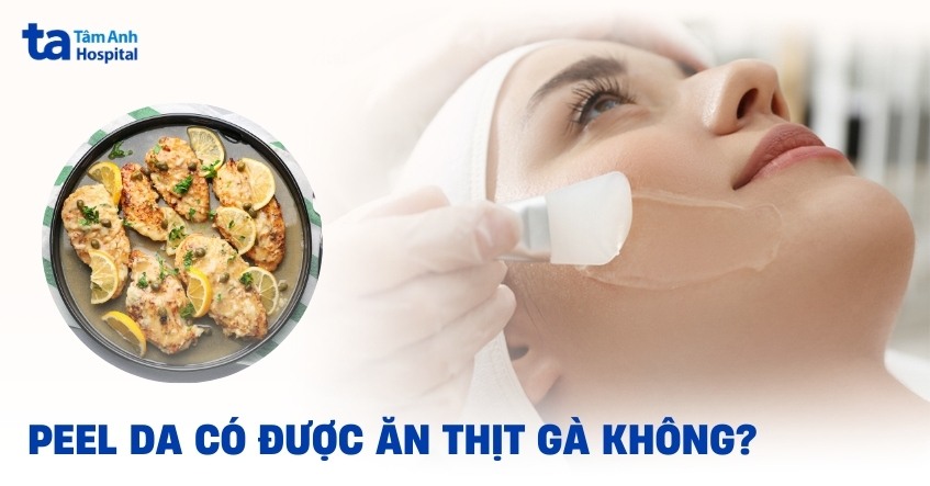 peel da có được ăn thịt gà không