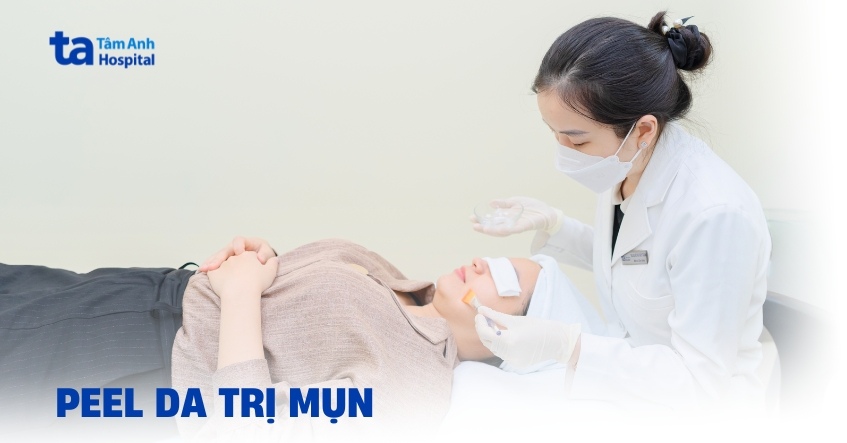 Liệu trình peel da trị mụn có thực sự đáng để thử không?