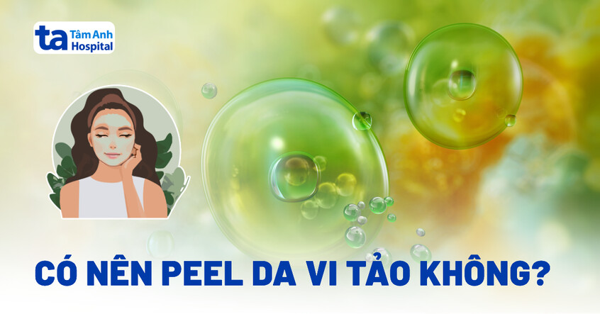 Peel da vi tảo có nên không? Lợi ích và hạn chế có thể gặp