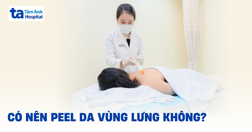 Peel lưng và những lợi ích nổi bật