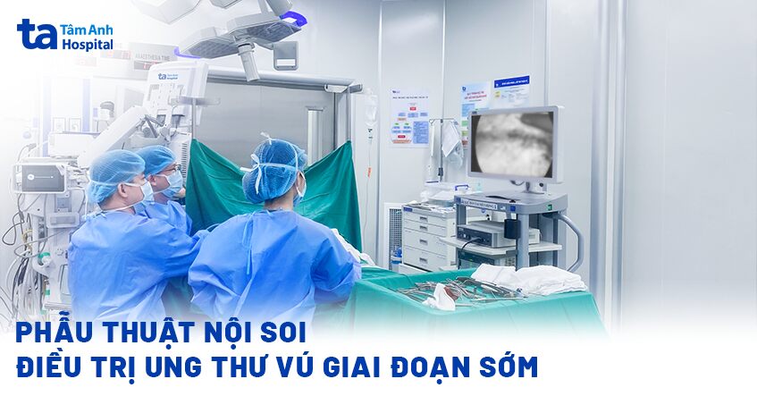 Phẫu thuật nội soi điều trị ung thư vú giai đoạn sớm