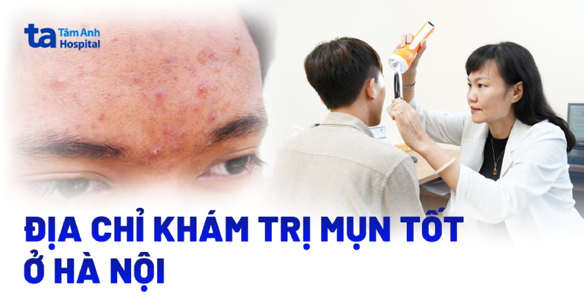 Bệnh viện, phòng khám trị mụn uy tín ở Hà Nội được đánh giá cao