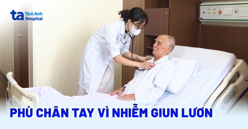 Phù chân tay vì nhiễm giun lươn