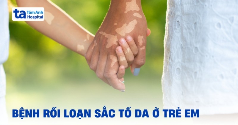 Vấn đề rối loạn sắc tố da ở trẻ em: Cần nhận diện từ sớm