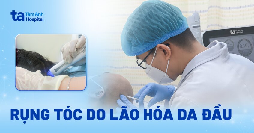 Rụng tóc do lão hóa da đầu