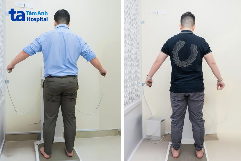 sau 2 tháng điều trị sỏi thận