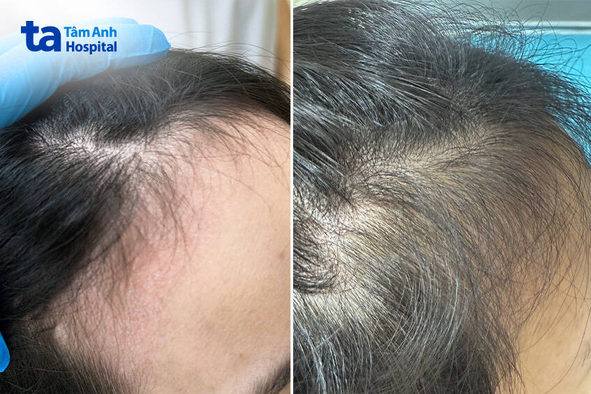 sau 3 lần điều trị cho khách hàng