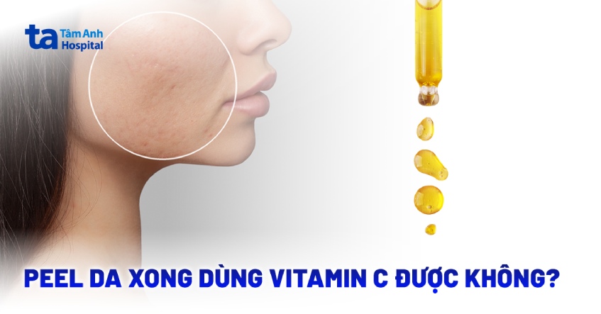 Sau khi peel da có nên dùng vitamin C không?