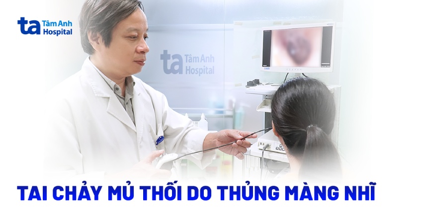 Tai chảy mủ thối do thủng màng nhĩ