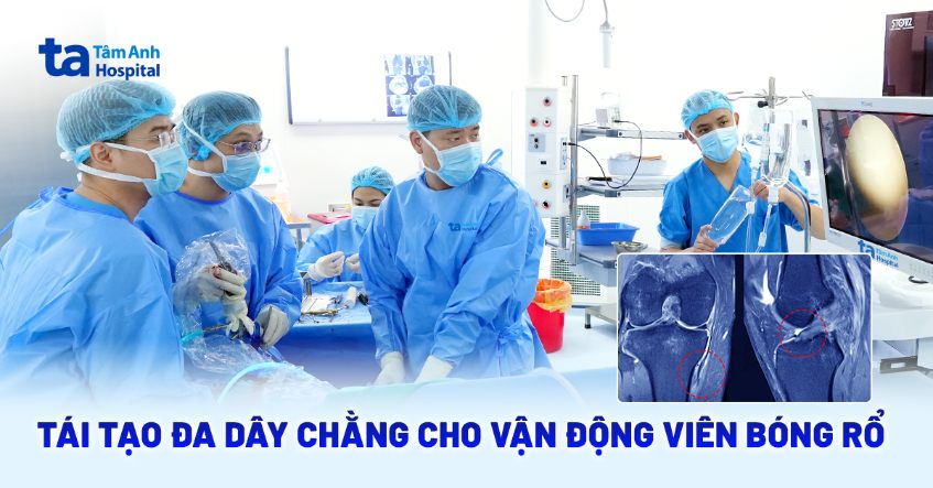 Tái tạo đa dây chằng cho vận động viên bóng rổ