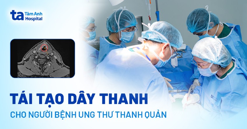 Tái tạo dây thanh cho người bệnh ung thư thanh quản