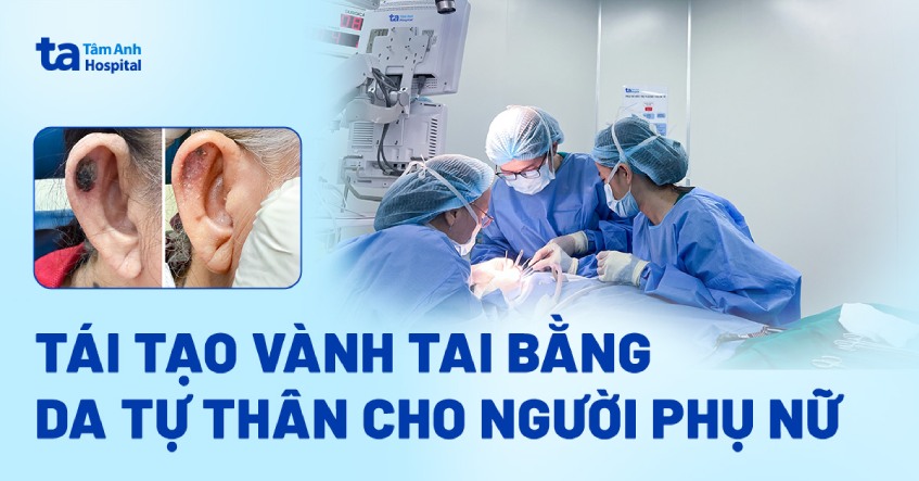 Tái tạo vành tai bằng da tự thân cho người phụ nữ