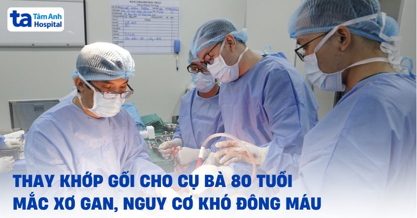Thay khớp gối cho cụ bà mắc xơ gan