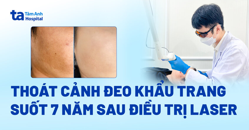 Thoát cảnh đeo khẩu trang suốt 7 năm sau điều trị laser