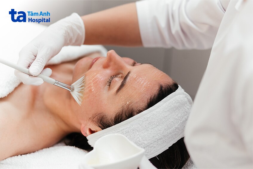 thủ thuật có thể trị sẹo rỗ từ nhẹ đến trung bình