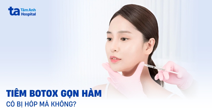 Tiêm botox gọn hàm có bị hóp má không?