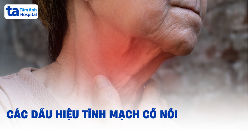 Tĩnh mạch cổ nổi khi nào? Cơ chế, nguyên nhân và phải làm sao?