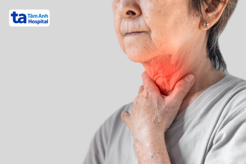 Tĩnh mạch ở cổ nổi lên thường có thể sờ hoặc nhìn thấy được