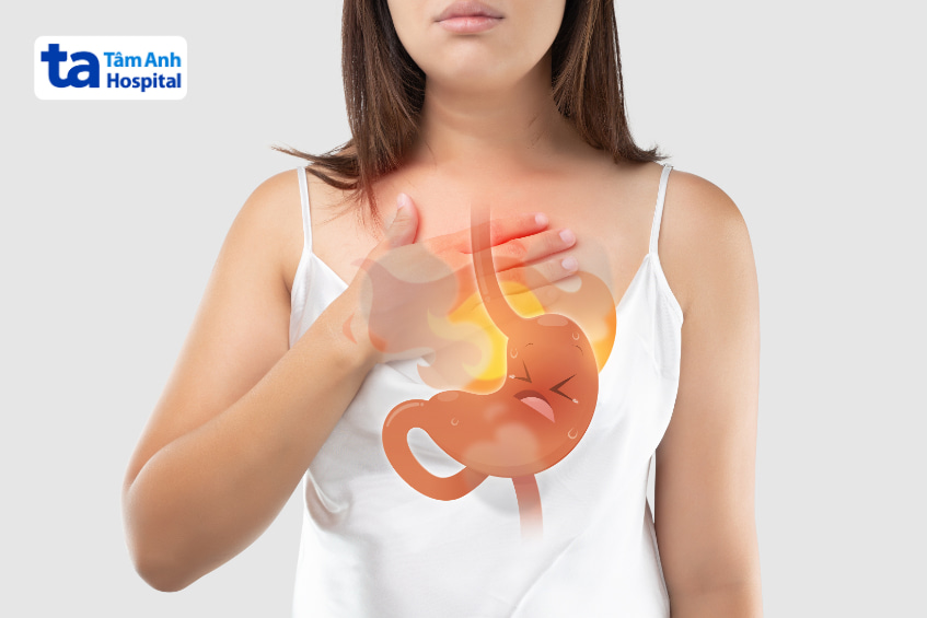 Người phụ nữ bị ợ nóng do axit dạ dày, hình minh họa chứng trào ngược thực quản.