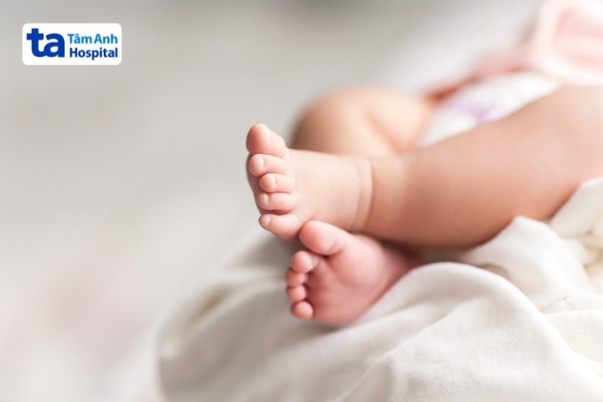 trẻ sinh ra có thể mắc cường giáp sơ sinh