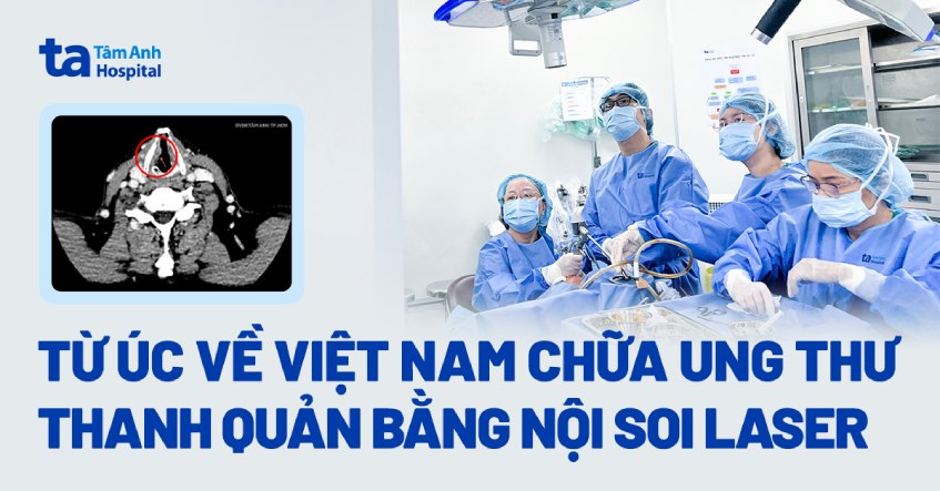 từ Úc về VN chữa ung thư thanh quản bằng nội soi laser