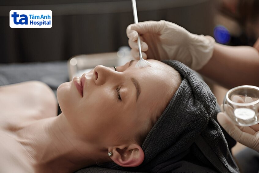 tuổi dậy thì có nên peel da không