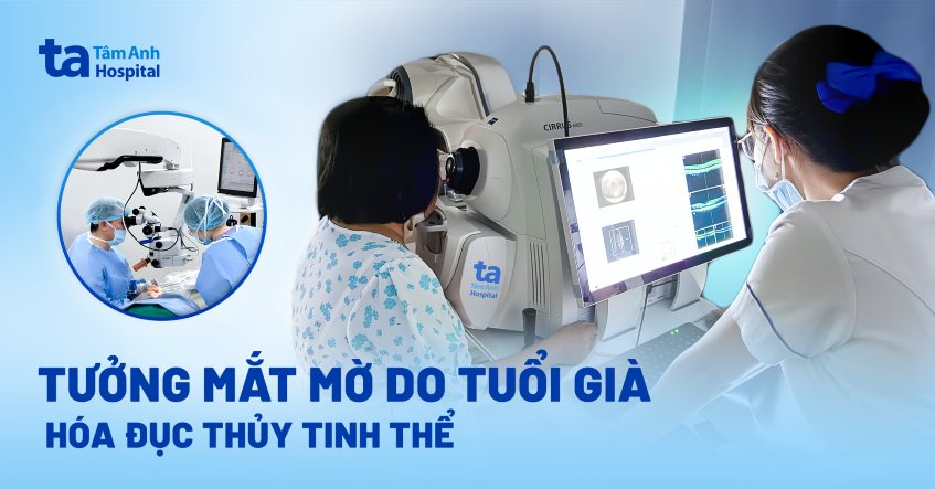 Tưởng mắt mờ do tuổi già hóa đục thủy tinh thể