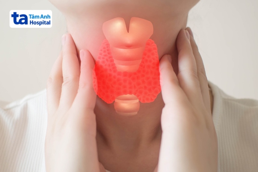 Tỷ Lệ Cường Giáp Tái Phát Là Bao Nhiêu? Tỷ Lệ Tái Phát Cụ Thể Sẽ Khác Nhau Ở Mỗi Người Và Cần Được Bác Sĩ Đánh Giá
