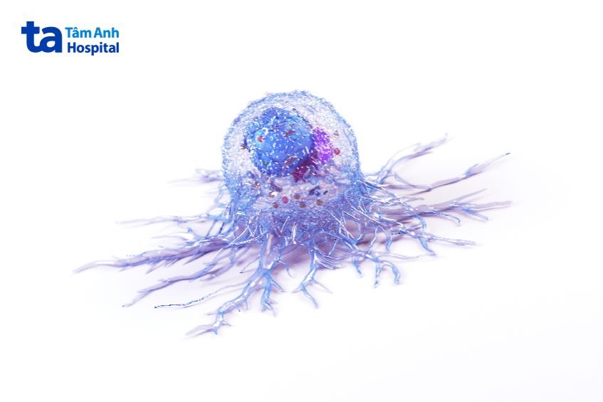 u ác tính lan rất nhanh