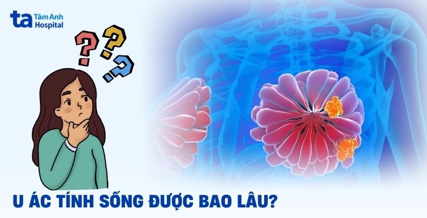 Bị u ác tính sống được bao lâu? Tiên lượng một số loại phổ biến