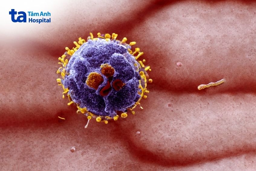 u lành tính nên mổ nếu phát triển