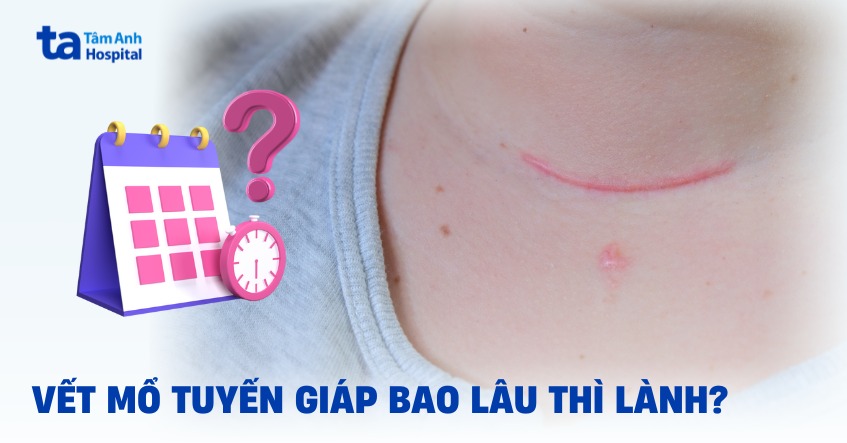 Vết mổ tuyến giáp bao lâu thì lành​?