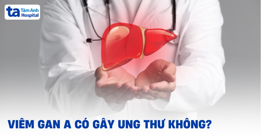 viêm gan a có gây ung thư không