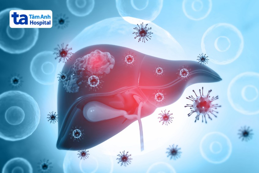 viêm gan b ở thể hoạt động