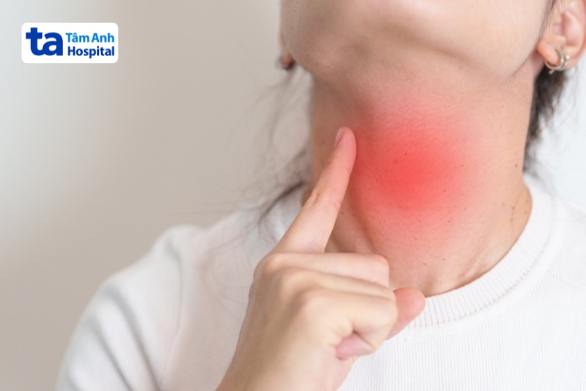 viêm sụn giáp thường do nhiễm khuẩn