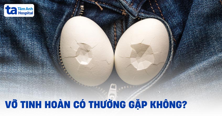 Vỡ tinh hoàn là gì? Nguyên nhân, dấu hiệu, chẩn đoán, phòng ngừa