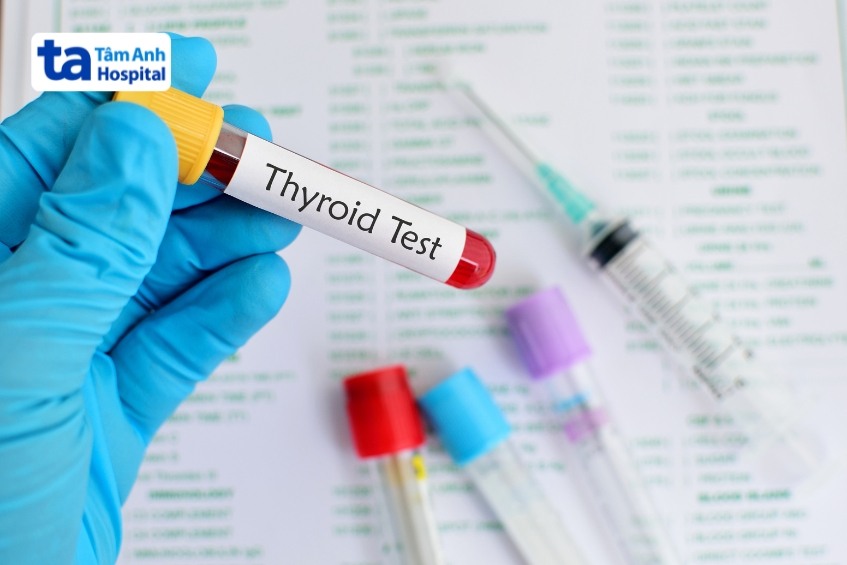 xét nghiệm chẩn đoán cường giáp thứ phát