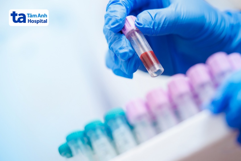 xét nghiệm máu chẩn đoán viêm gan b