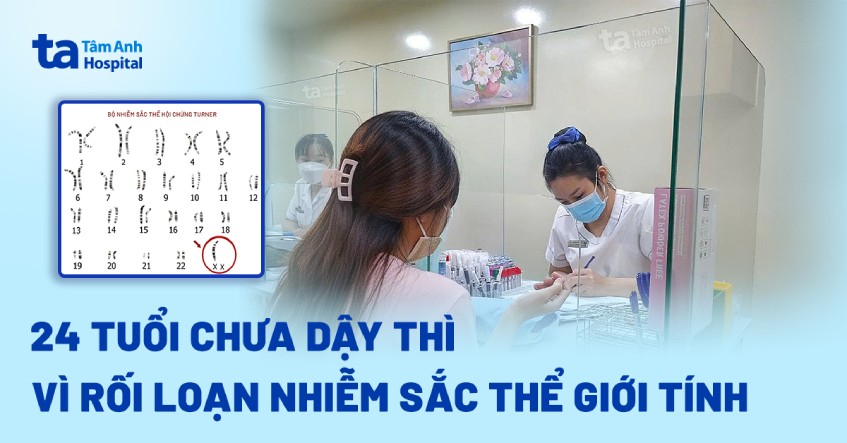 24 tuổi chưa dậy thì vì rối loạn nhiễm sắc thể giới tính
