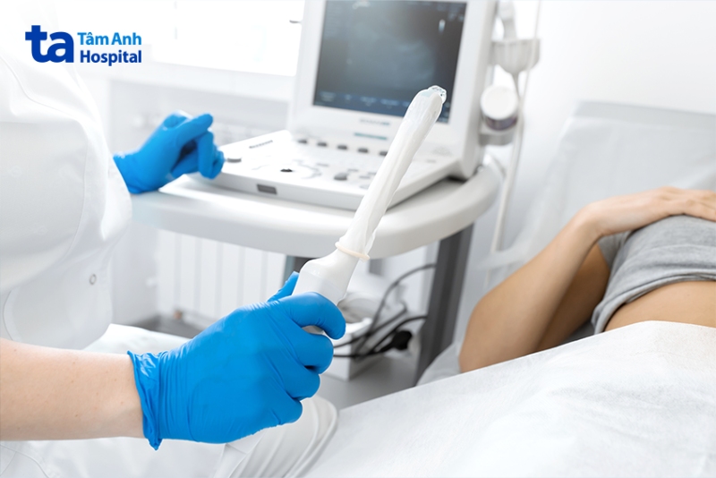 bác sĩ chuẩn bị nội soi