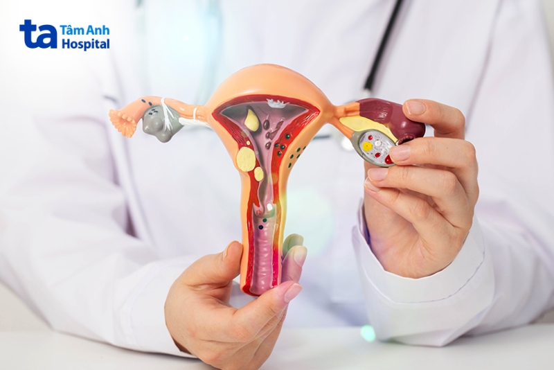 bác sĩ hướng dẫn kiến thức buồng trứng
