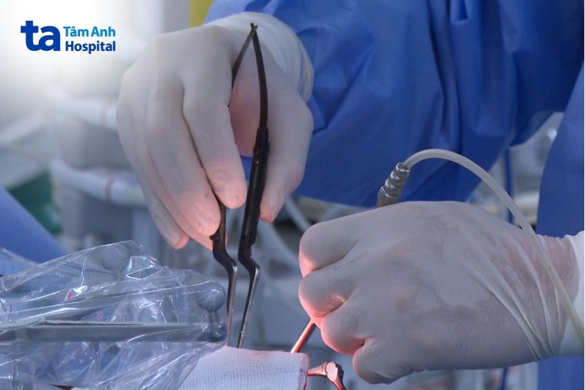 bác sĩ mổ u não