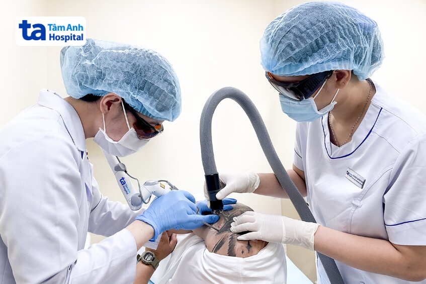 bác sĩ xóa xăm cho khách hàng