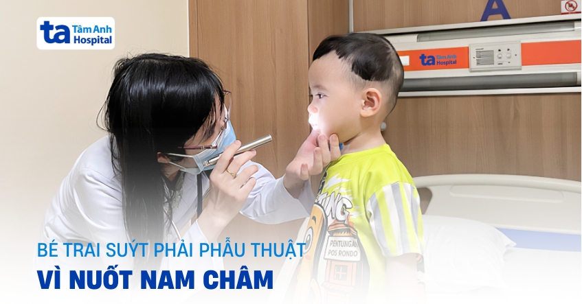 Bé trai suýt phải phẫu thuật vì nuốt nam châm