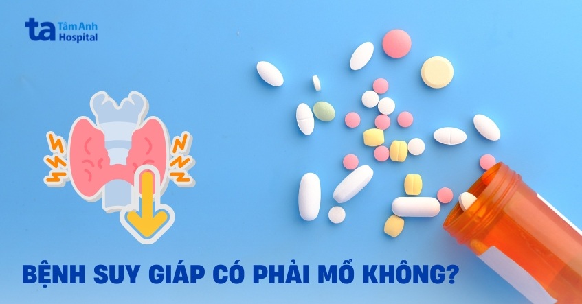 Bệnh suy giáp có phải mổ không?