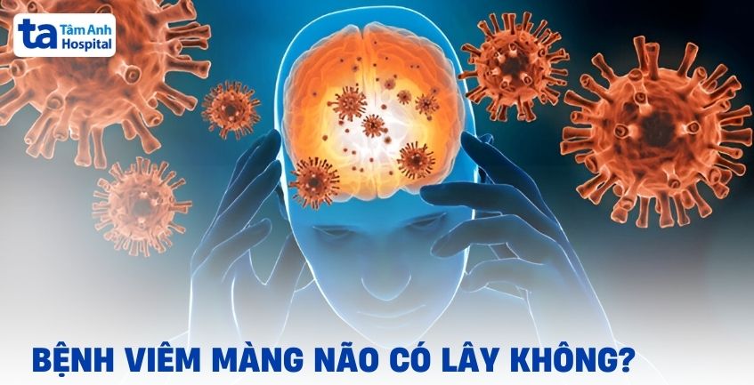 Viêm màng não có lây không? Bệnh lây qua đường nào?