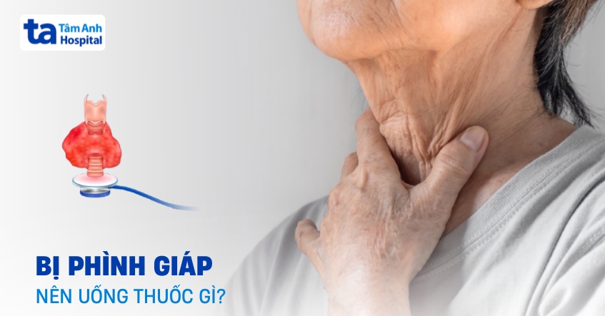 Bị phình giáp nên uống thuốc gì? Uống như thế nào cho đúng?