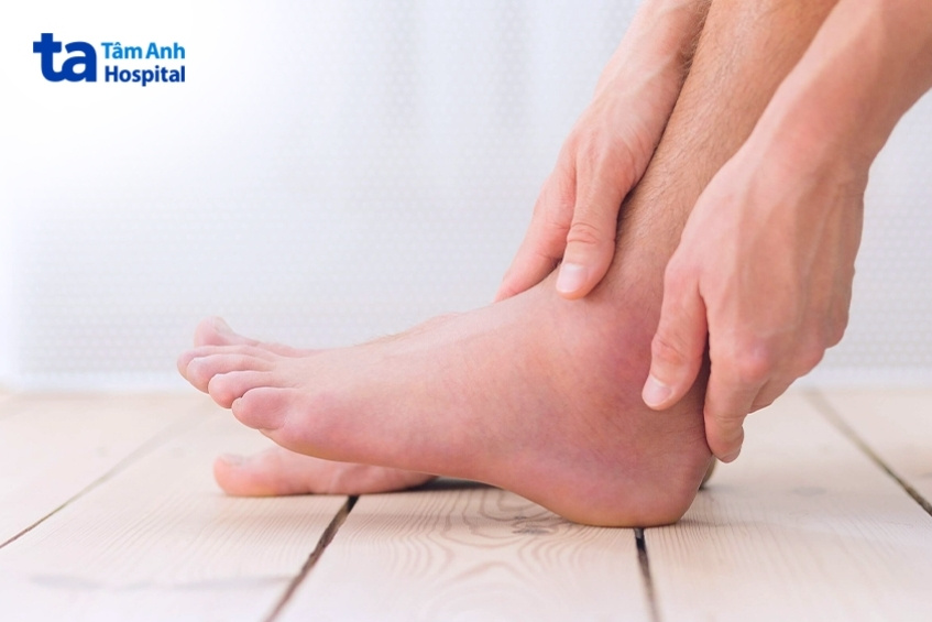 bong gân bàn chân gây sưng tấy