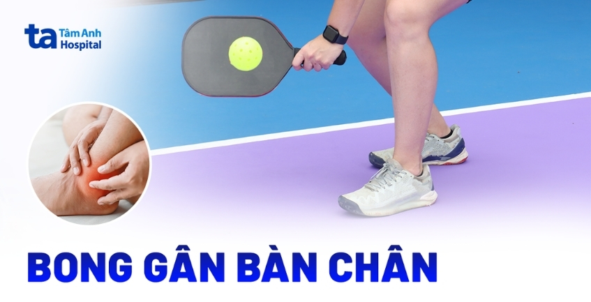 Người bệnh nên làm gì khi bị bong gân bàn chân​?