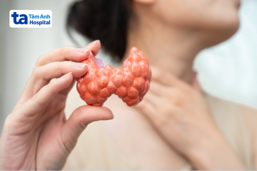 bướu cổ to có thể gây mất thẩm mỹ, chèn ép các cơ quan
